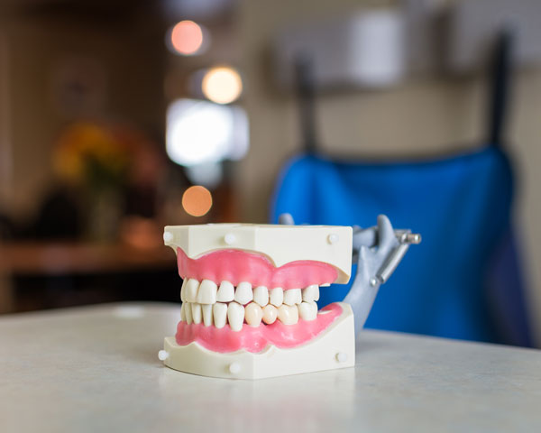 model mouth with gums and teeth on a table