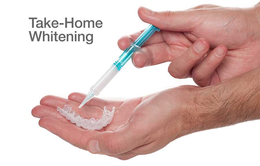 a person's hands injecting teeth mold with whitening solution