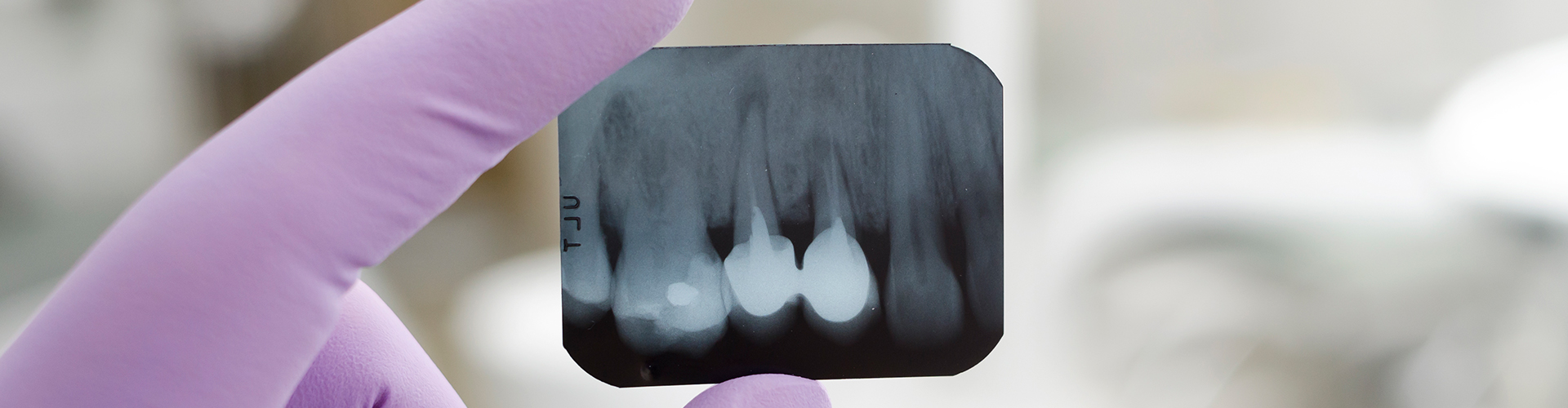 Dentist Reviewing Dental X-Ray in Seattle Office