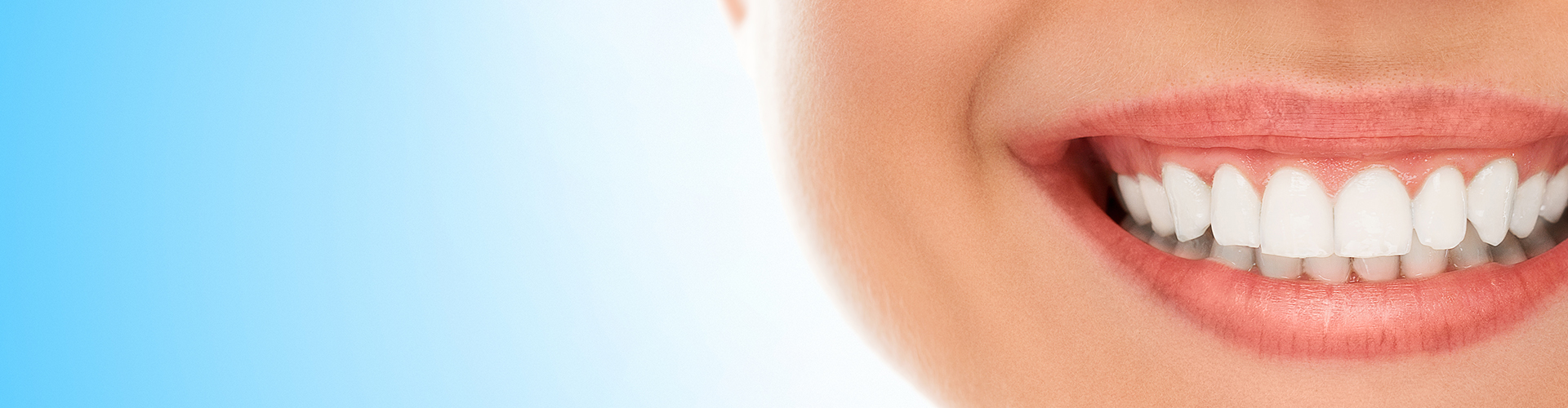 Upclose View of Woman's Teeth After Seattle Dental Appointment