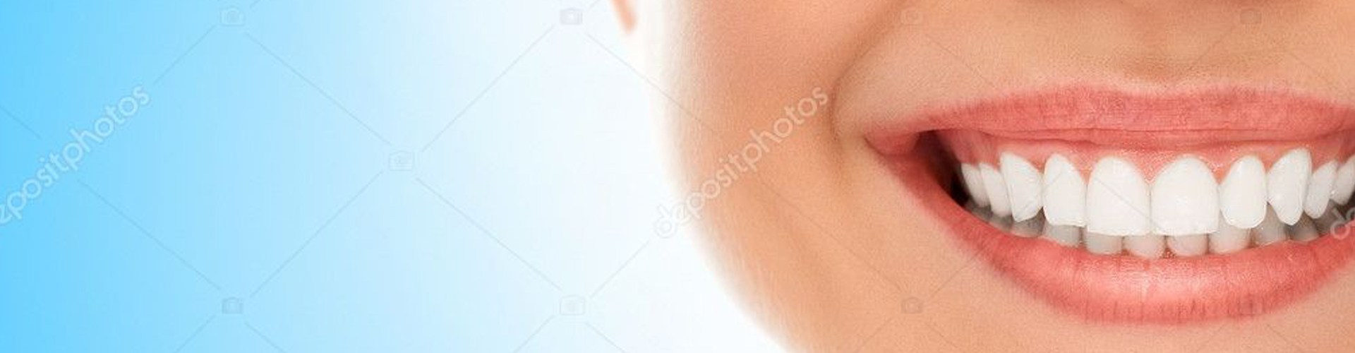 Root Canals